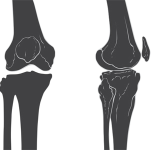 Knee Skeleton Diagram
